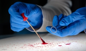 Ręce w gumowych rękawiczkach probówką.